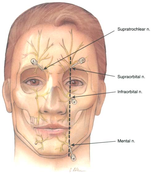 foramen-supraorbitale-med-kom